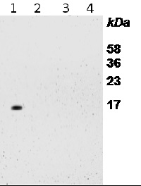 RPS14 | 40S ribosomal protein S14-1 in the group Antibodies Plant/Algal / DNA/RNA/Cell Cycle / Translation at Agrisera AB (Antibodies for research) (AS12 2111)